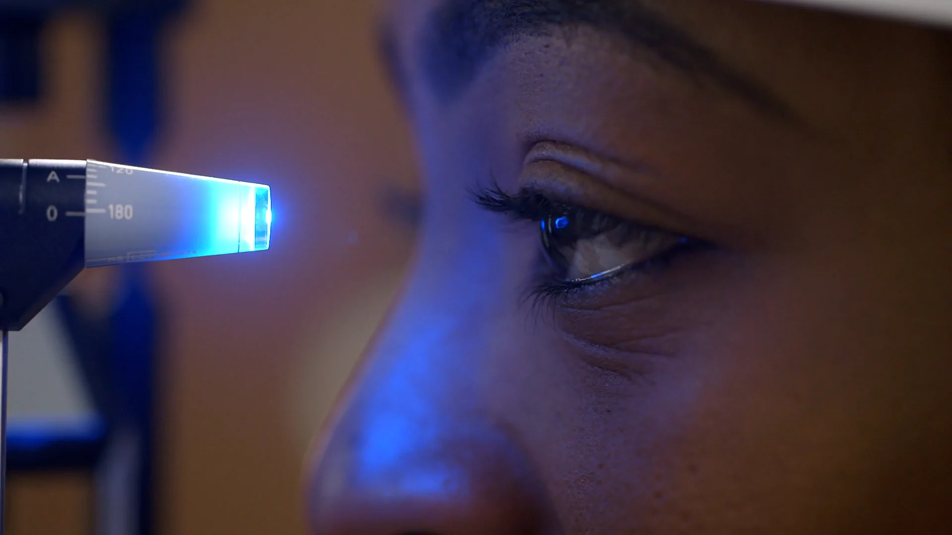 Screening and Treatment for Glaucoma